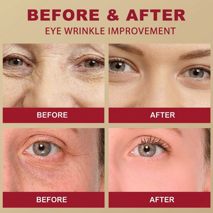 Seoul 1988 Retinal Eye Cream