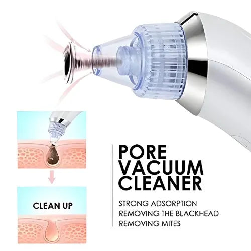Derma Suction Pro Blackhead Remover