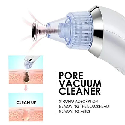 Derma Suction Pro Blackhead Remover