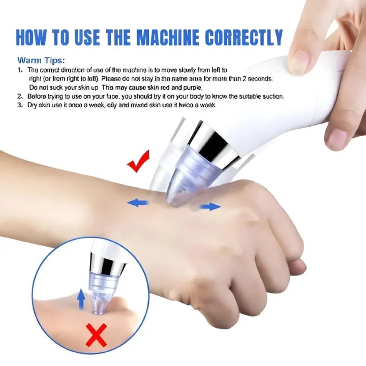 Derma Suction Pro Blackhead Remover