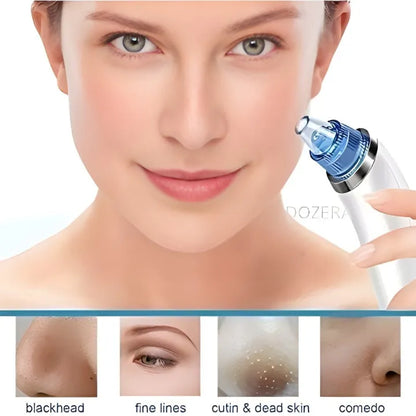 Derma Suction Pro Blackhead Remover