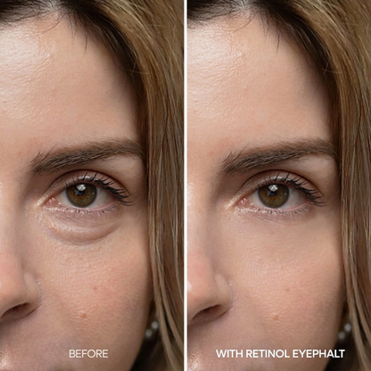 Dr. Melaxin Eyephalt Cream