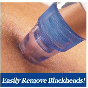 Derma Suction Pro Blackhead Remover